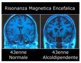 alcol5