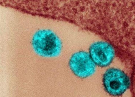 Aids, forbici molecolari per rimuovere lʼHiv.