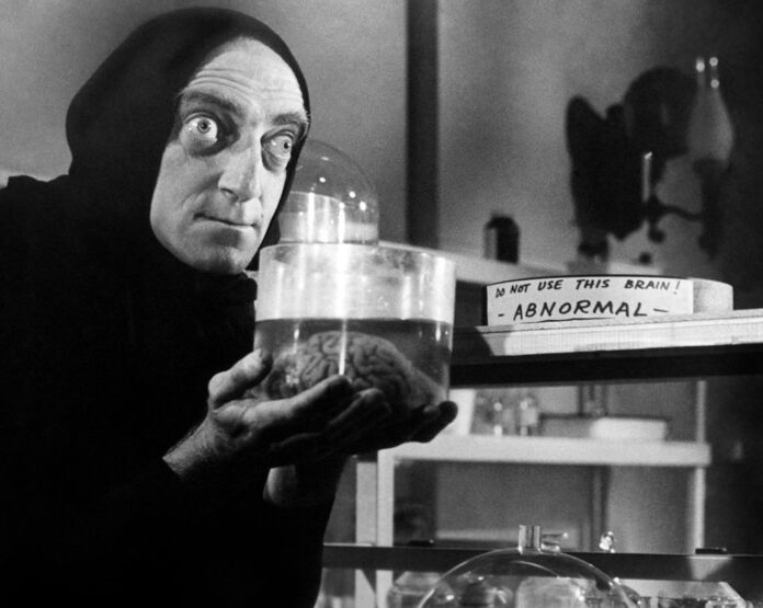 Marty Feldman, il noto attore era affetto da esoftalmo e ipertiroidismo.