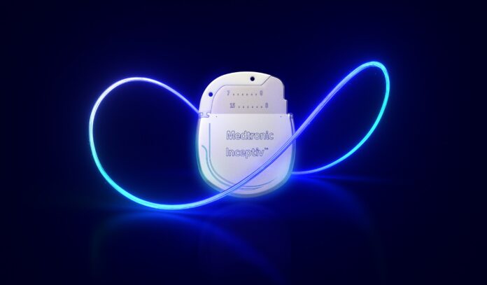 Inceptiv Neurostomulator