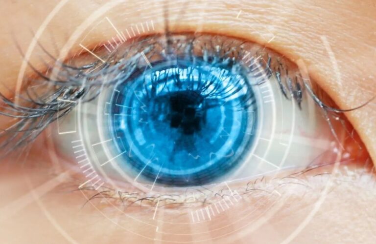 “Mai visto così bene”: perché sempre più persone scelgono le lenti intraoculari per correggere la miopia.