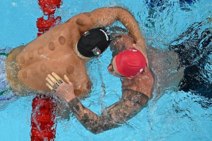 martinenghi_coppettazione_afp