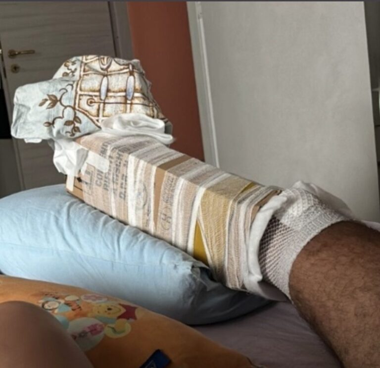 In ospedale a Patti mancano le stecche, la frattura viene bloccata con un cartone.