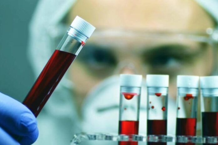 Provette_di_sangue