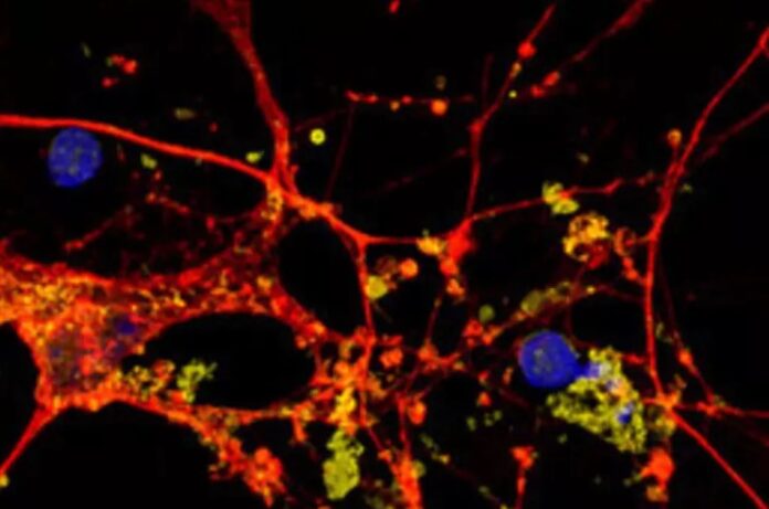 Neuroni_di_organoidi_cerebrali