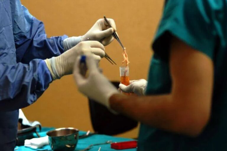 Trapianti, a Modena il primo in Europa di fegato da donatore vivente con robot.