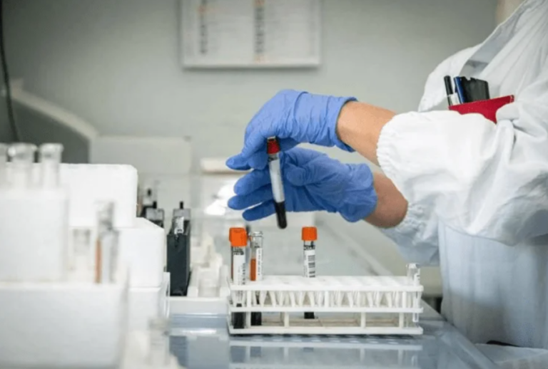 Alzheimer, allo studio nuovo test del sangue per diagnosi precoce.