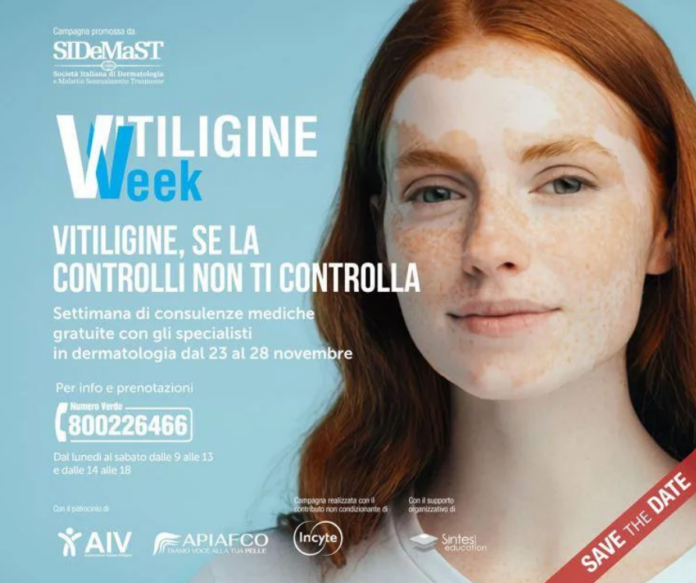 Vitiligine_1